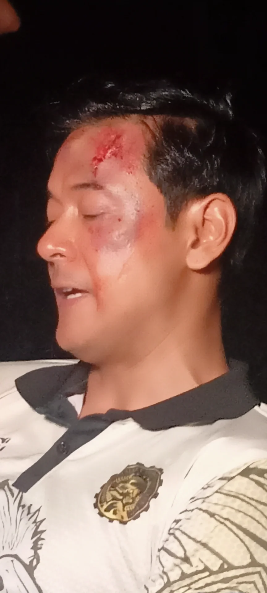 inbound3190679059228203523